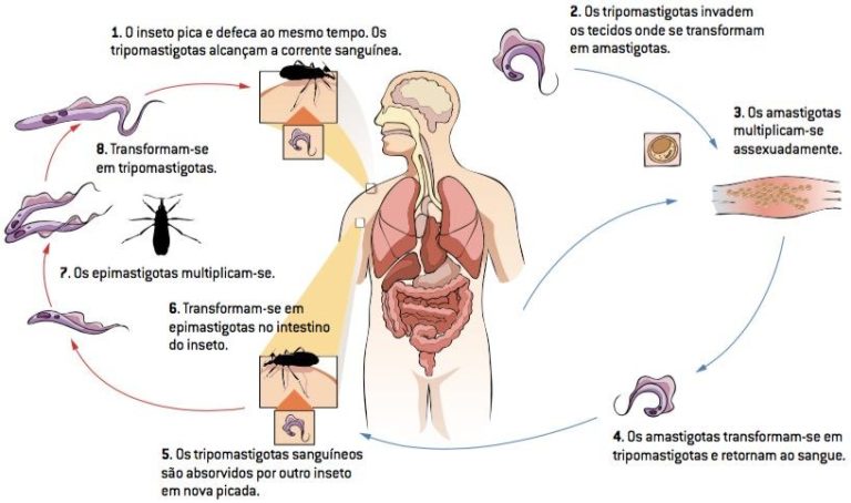 Doença de Chagas Vetor sintomas e prevenção Cola da Web